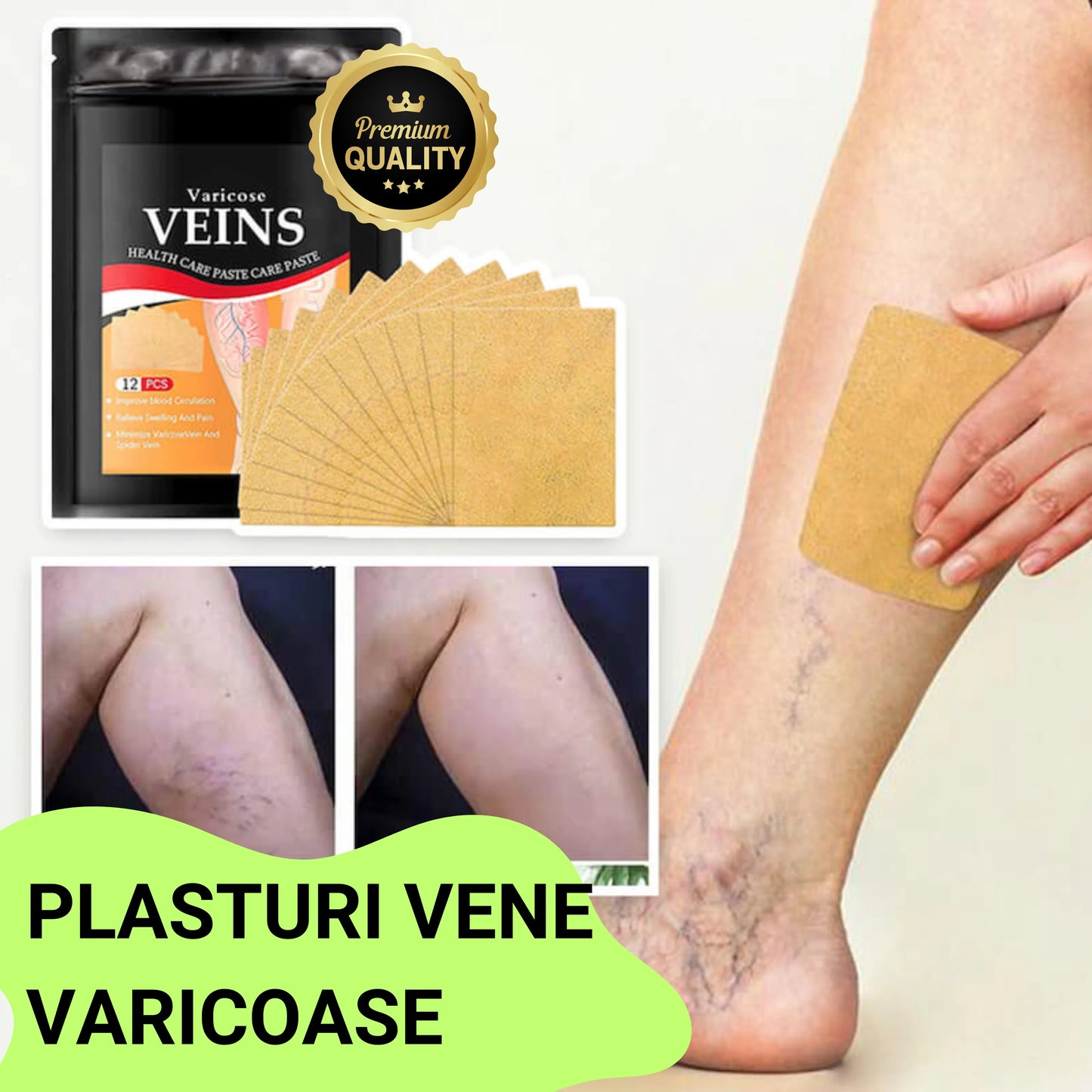 Set de plasturi pentru vene varicoase