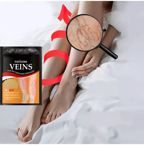 Set de plasturi pentru vene varicoase